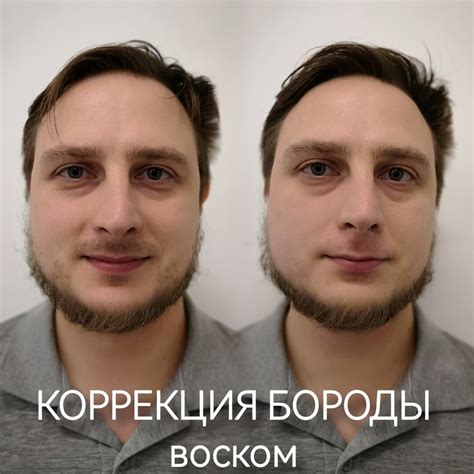 ЭЛЕКТРОЭПИЛЯЦИЯ | ШУГАРИНГ | ДЕПИЛЯЦИЯ СПб 2024 | ВКонтакте