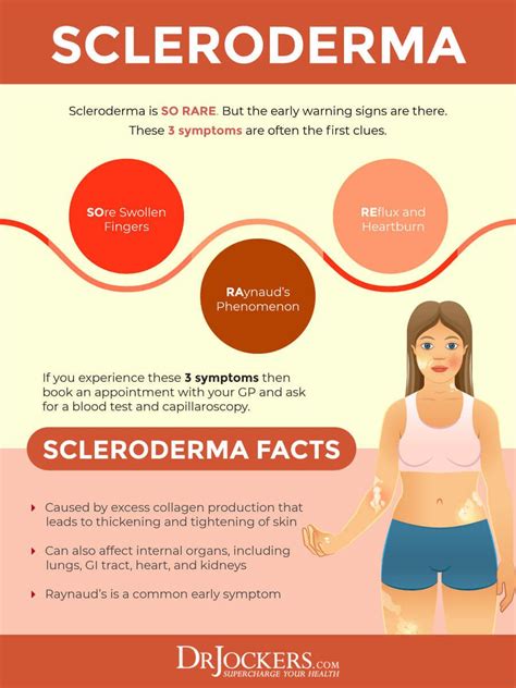 Scleroderma causes symptoms and natural support strategies – Artofit