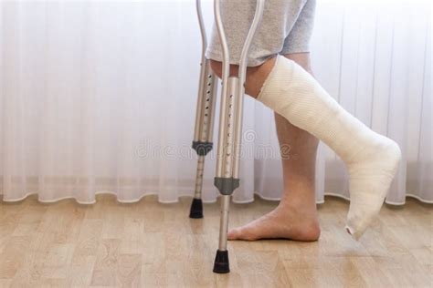 Close-up of Man Leg in Plaster Cast Using Crutches while Walking. Stock Image - Image of ...