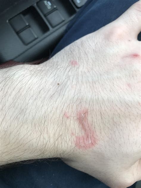 Always wear your gloves when handling melted plastic. : r/OSHA