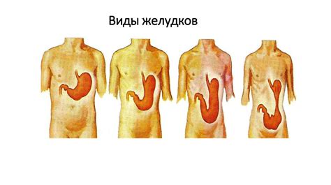 Желудок. Анатомия. Физиология. Виды дисфункций - презентация онлайн