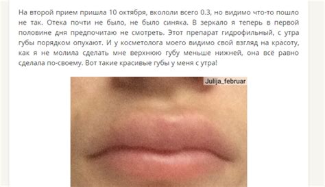 Филлеры для губ: отзывы, фото до и после, цена, увеличение, коррекция ...