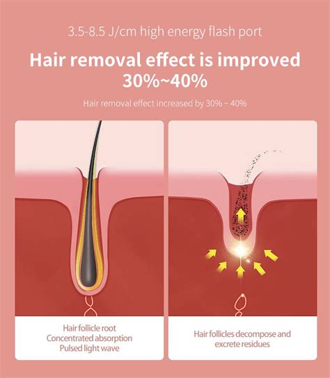 Home Use Permanent Hair Removal Machine | PS Beauty Tools