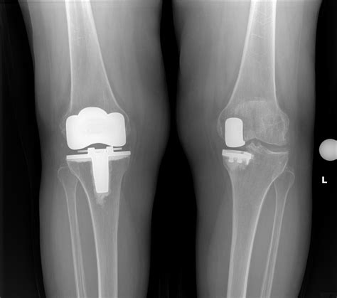 Dr. Craig J. Della Valle, Hip and Knee surgeon SN1 - Dr. Craig J. Della