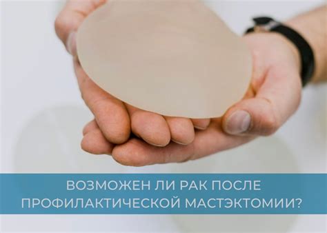 Рак после профилактической мастэктомии? | Владимир Соболевский ...