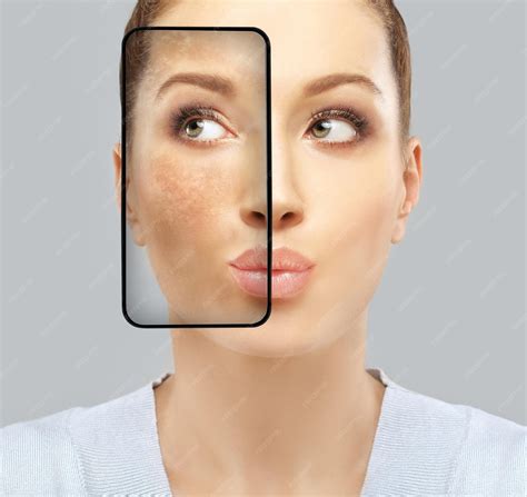 Premium Photo | Dark spots hyperpigmentation melasma or chloasma