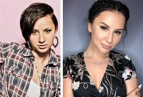 Певица асти до пластики фото до и после биография