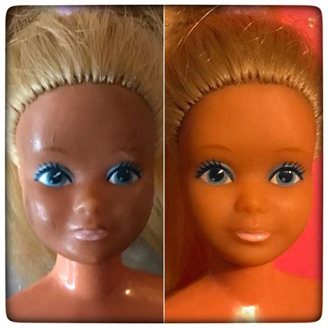 Clitoridectomy Before And After 6