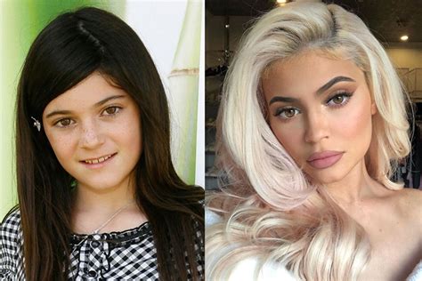 Kylie Jenner Before and After (What She Really Looks Like) - TSC