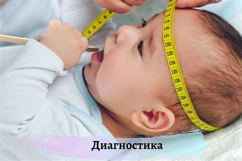 Наружная гидроцефалия: симптоматика и лечение патологии головного мозга ...