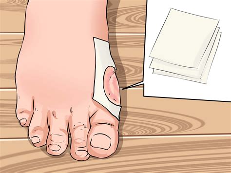 What Causes Blisters In Running Shoes at Kaitlyn Nuyts blog