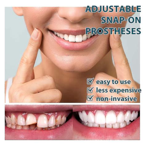 Adjustable Buckle Denture Smile Teeth Customizable Temporary Perfect