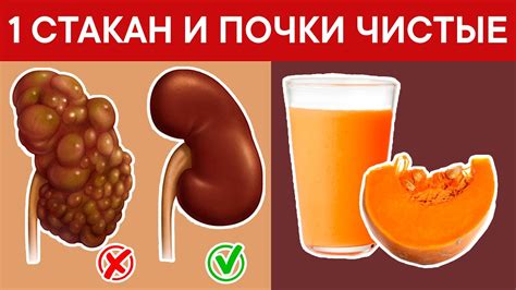 Мощная и эффективная чистка ПОЧЕК. Просто нужно взять 1 стакан ...