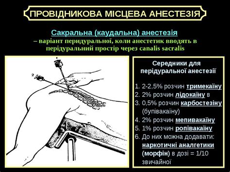 Реаніматологія - презентація з медицини