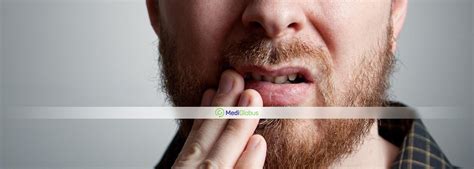 Как лечат рак губы за рубежом? — MediGlobus