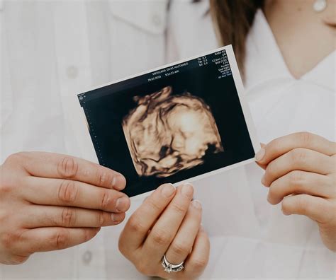 Radiografía De Tórax Precio Salud Digna 8