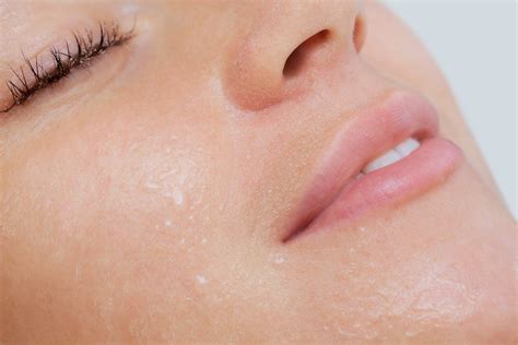 Is Facial Steaming Good For Eczema at Rita Clark blog