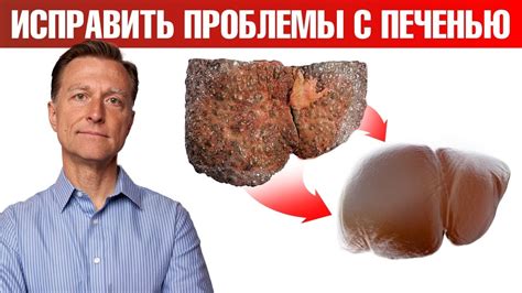 6 самых эффективных способов для восстановления печени🙌 - YouTube