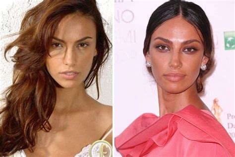 Madalina Ghenea Before and After Plastic Surgery