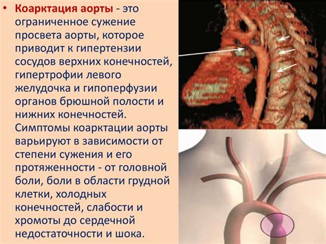 Каптоприл Акос: инструкция по применению, от чего таблетки, показания ...