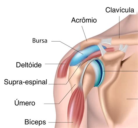 O Que Causa Bursite No Ombro - O que é Bursite, quais são os sintomas e como é feito o tratamento
