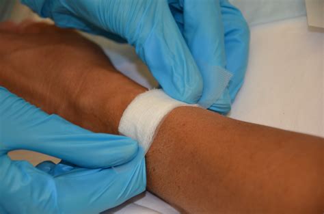 converting  iv infusion   saline lock  removal