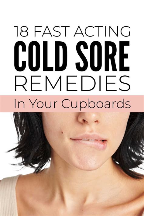 Natural Remedies For Cold Sores