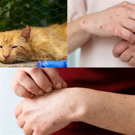 ciri gigitan kutu kucing  manusia   diketahui