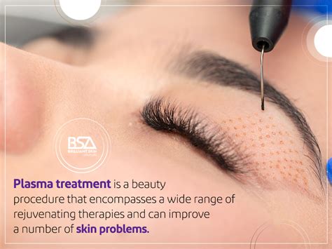 fibroblast treatment sydney