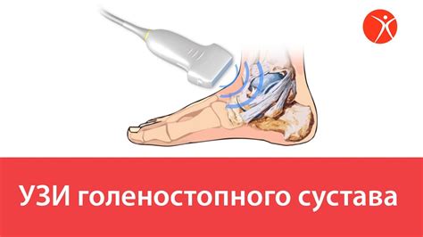 УЗИ голеностопного сустава - YouTube