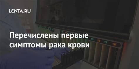 Перечислены первые симптомы рака крови: Общество: Россия: Lenta.ru