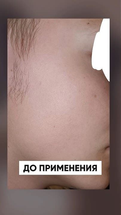 СРЕДСТВО ДЛЯ РОСТА БОРОДЫ / Результат за 3 месяца - YouTube