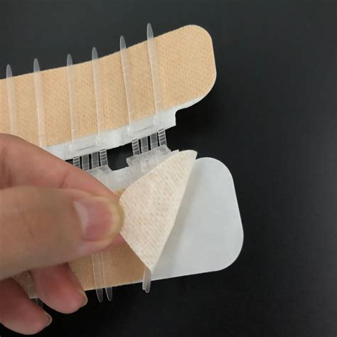 Adhesives For Skin Closure at Lenore Schwartz blog