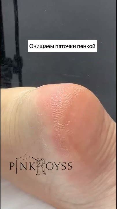 Полировка пяток . Масло для кожи и ногтей 1530 р #педикюр#курсыпедикюра ...