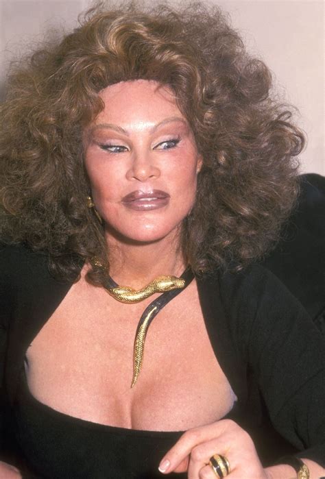 catwoman plastic surgery pictures 15