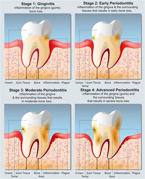 smoking affects  teeth willow pass dental care