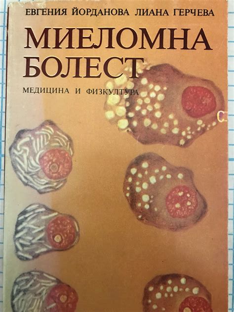 Миеломна болест | Ортограф - антикварна книжарница