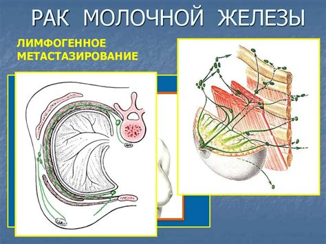 Заболевания молочной железы - презентация онлайн