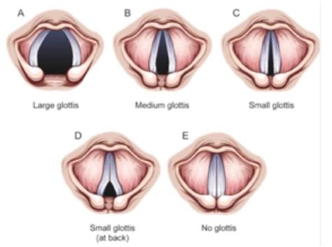 Anatomy Final: Glottis Shapes Diagram | Quizlet