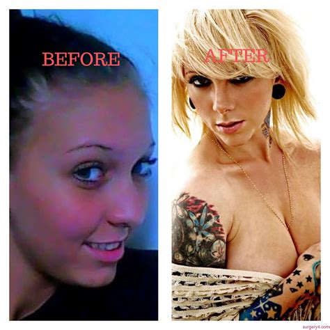 Jennifer Lopez Plastic Surgery Photos [Before & After] - Surgery4