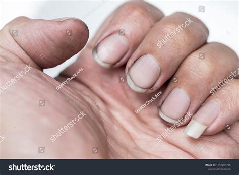 germs  nails microscope  laura painter blog