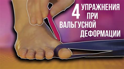 4 упражнения при вальгусной деформации - YouTube