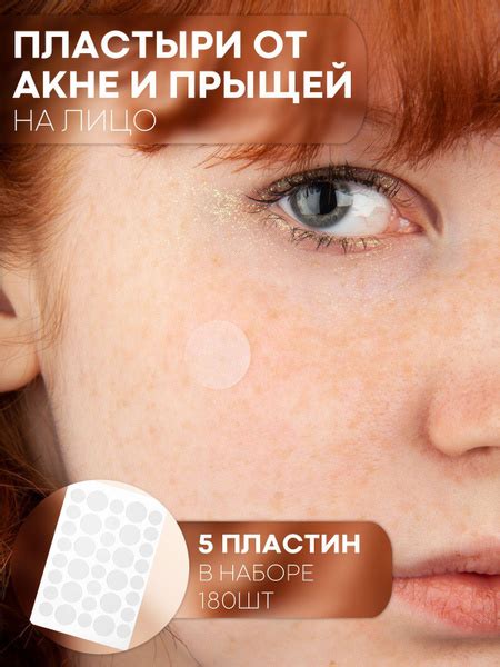 Патчи от прыщей - точечные пластыри для проблемной кожи лица, акне и от ...