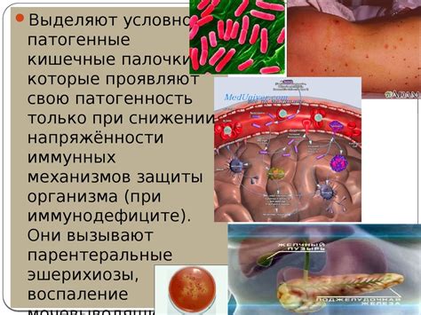 Кишечные инфекции - презентация онлайн