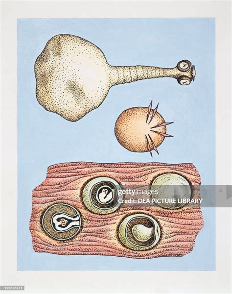 taenia solium cysticercus diagram