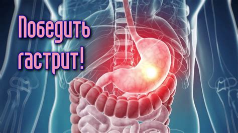7 ПРОДУКТОВ, которые ПОМОГУТ ПОБЕДИТЬ ГАСТРИТ - YouTube