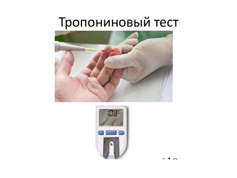 Нестабильная cтенокардия. Острый коронарный синдром - презентация онлайн