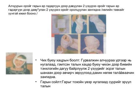 цус алдалтын үед