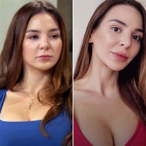 90 Day’s Anfisa Nava Plastic Surgery: Photos Before, After | In Touch