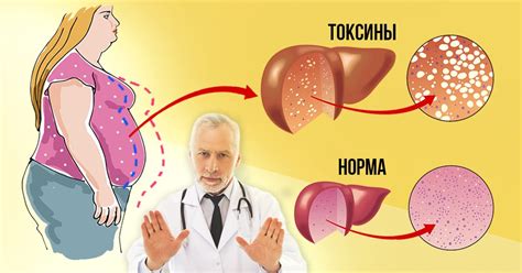 Очистка печени